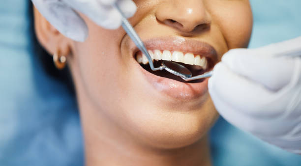Best Emergency Tooth Extraction in Safety Harbor, FL
